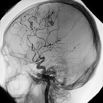 Normal Brain to compare to what brain death looks like.